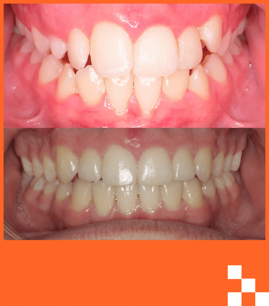 Craig Before & After